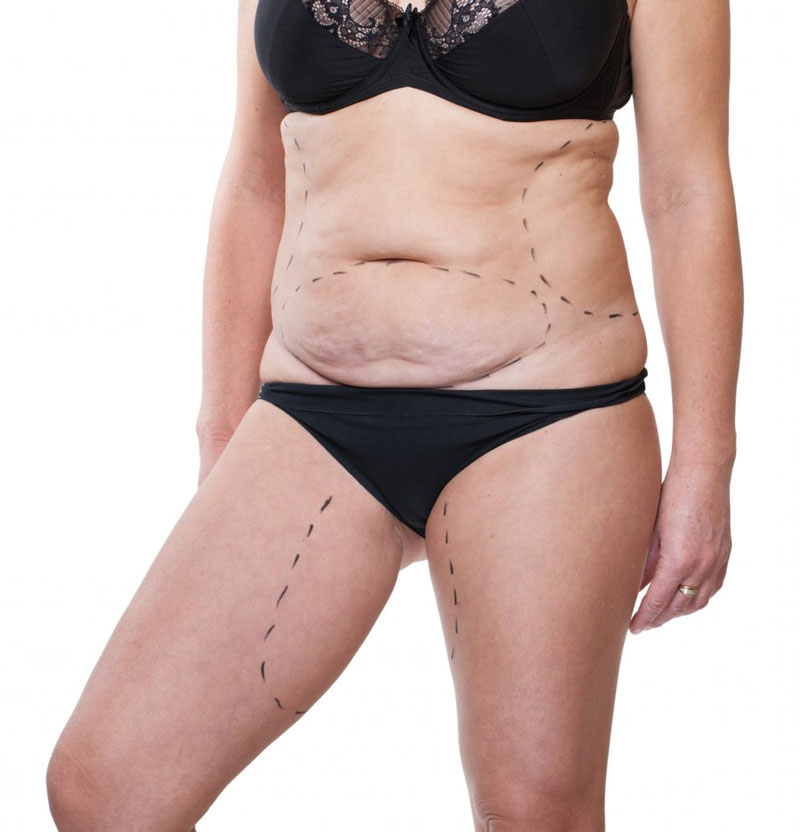 body-slimming (5).jpg