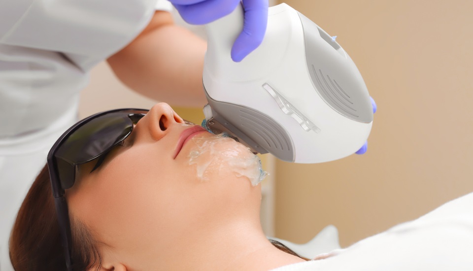 IPL Permanent Hair Removal Post-Treatment Care and Maintenance.jpg